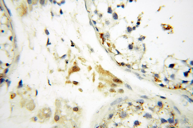 PPCS Antibody in Immunohistochemistry (Paraffin) (IHC (P))