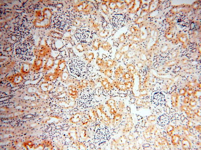 PPCS Antibody in Immunohistochemistry (Paraffin) (IHC (P))