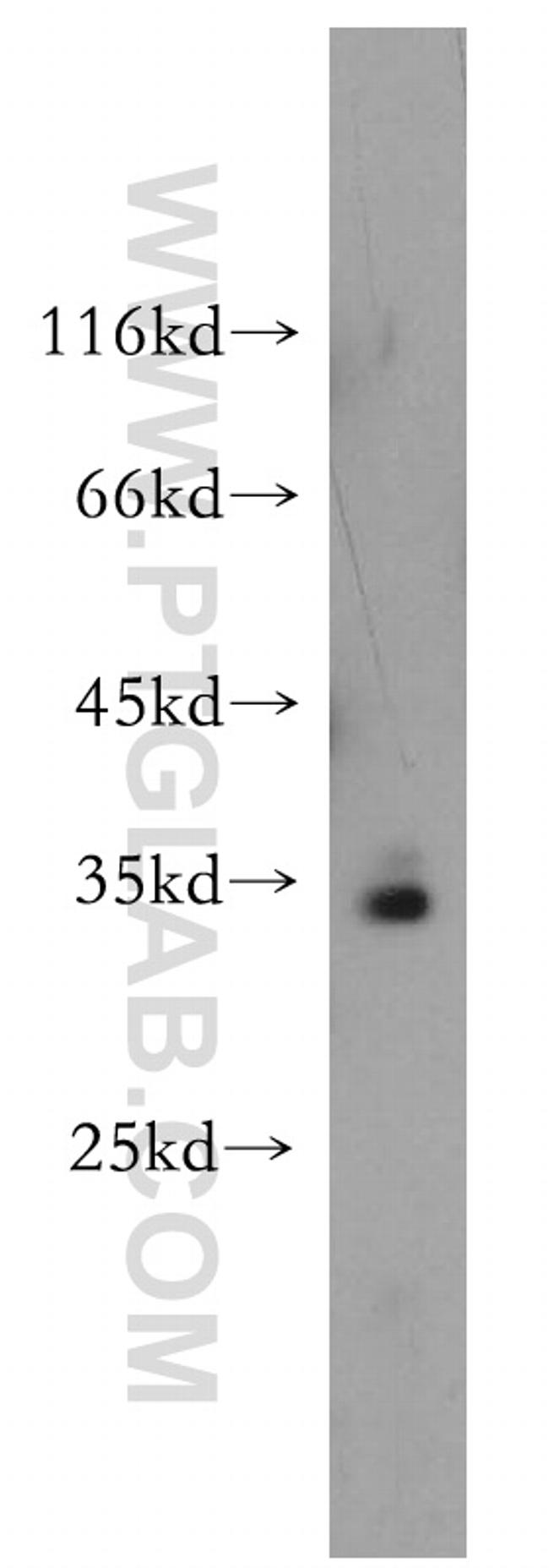 PPCS Antibody in Western Blot (WB)