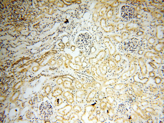 DNA polymerase beta Antibody in Immunohistochemistry (Paraffin) (IHC (P))