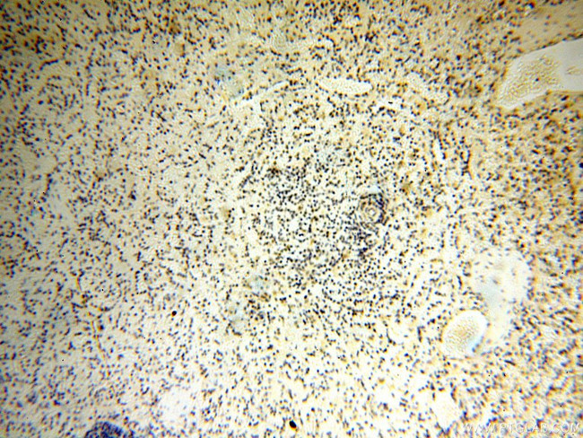 DNA polymerase beta Antibody in Immunohistochemistry (Paraffin) (IHC (P))