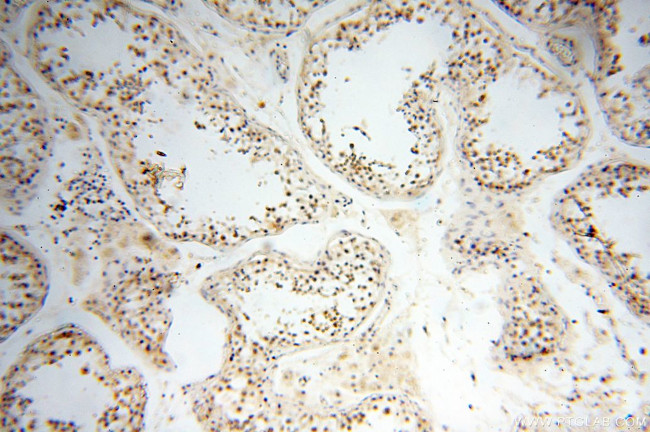 DNA polymerase beta Antibody in Immunohistochemistry (Paraffin) (IHC (P))