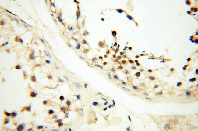 DNA polymerase beta Antibody in Immunohistochemistry (Paraffin) (IHC (P))