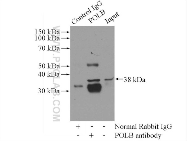 DNA polymerase beta Antibody in Immunoprecipitation (IP)