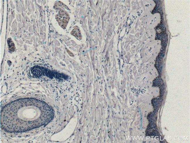 ST8SIA3 Antibody in Immunohistochemistry (Paraffin) (IHC (P))