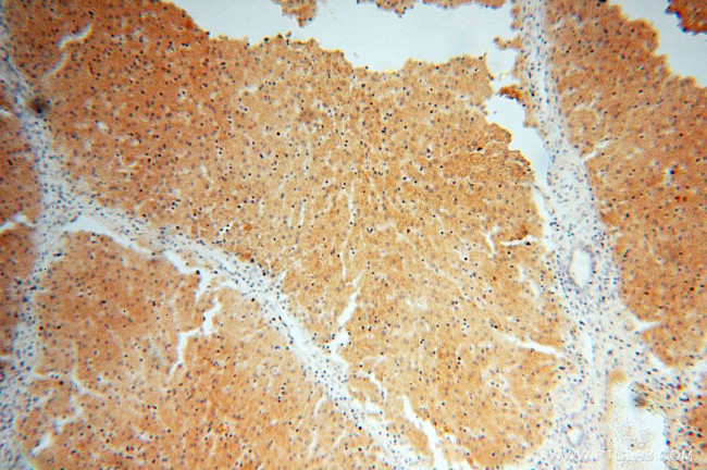 ST8SIA3 Antibody in Immunohistochemistry (Paraffin) (IHC (P))