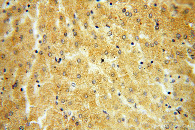 ST8SIA3 Antibody in Immunohistochemistry (Paraffin) (IHC (P))