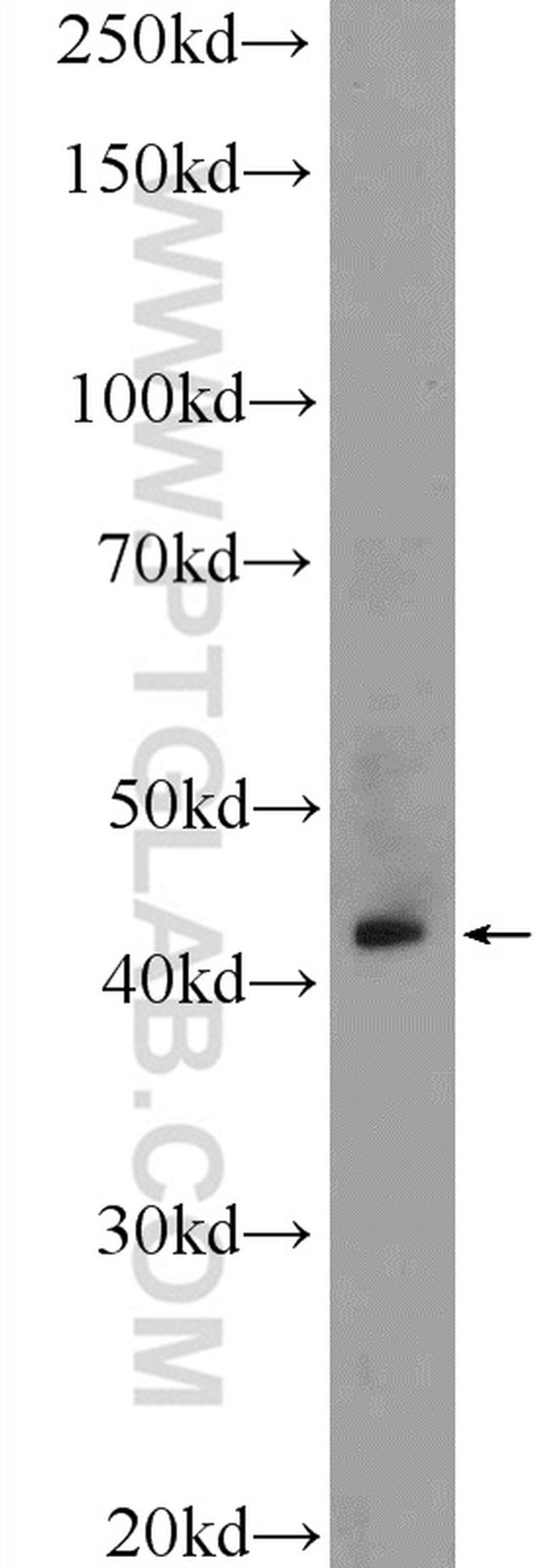 RRM2B/p53R2 Antibody in Western Blot (WB)