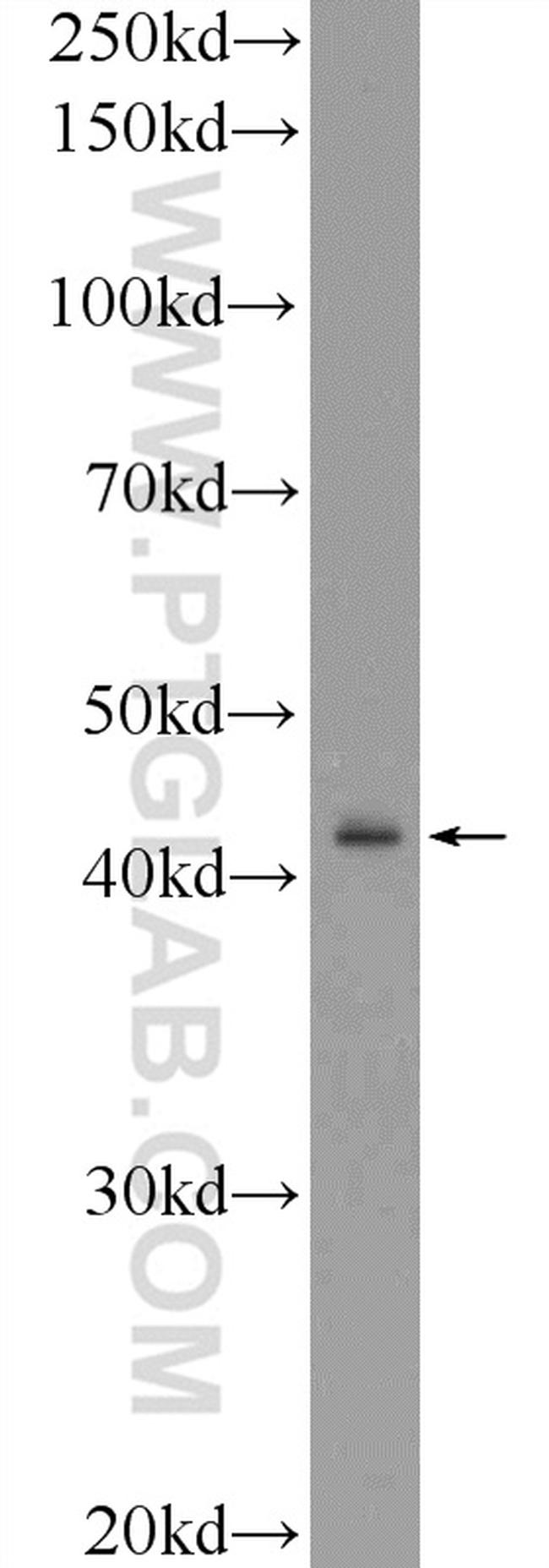 RRM2B/p53R2 Antibody in Western Blot (WB)