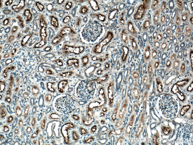 MME/CD10 Antibody in Immunohistochemistry (Paraffin) (IHC (P))