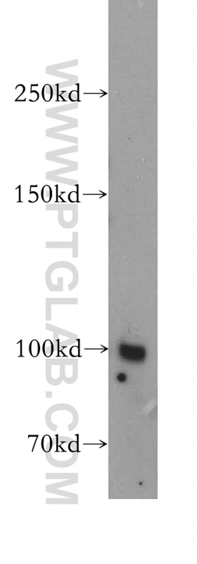 MME/CD10 Antibody in Western Blot (WB)