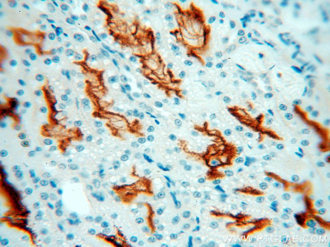 MME/CD10 Antibody in Immunohistochemistry (Paraffin) (IHC (P))