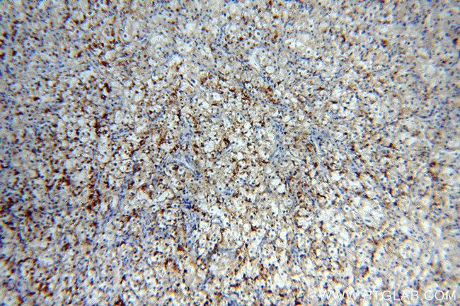 MME/CD10 Antibody in Immunohistochemistry (Paraffin) (IHC (P))