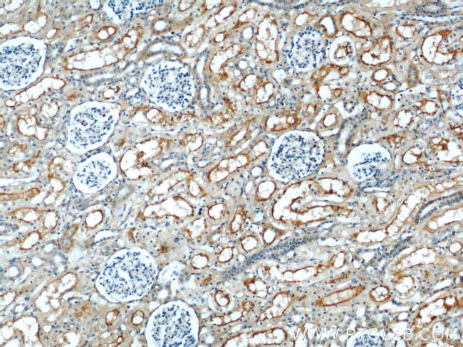 MME/CD10 Antibody in Immunohistochemistry (Paraffin) (IHC (P))