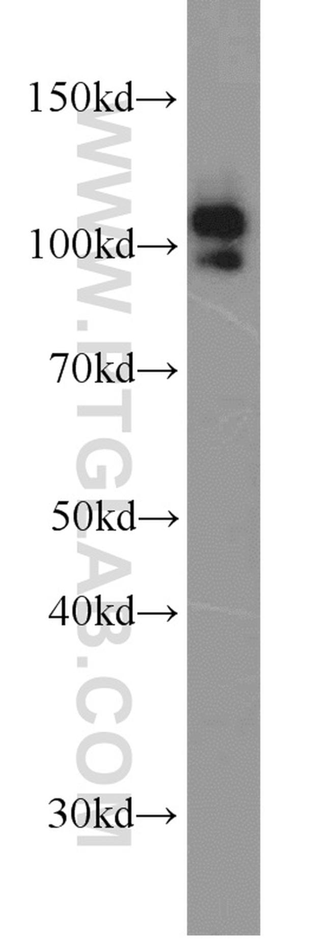 MME/CD10 Antibody in Western Blot (WB)