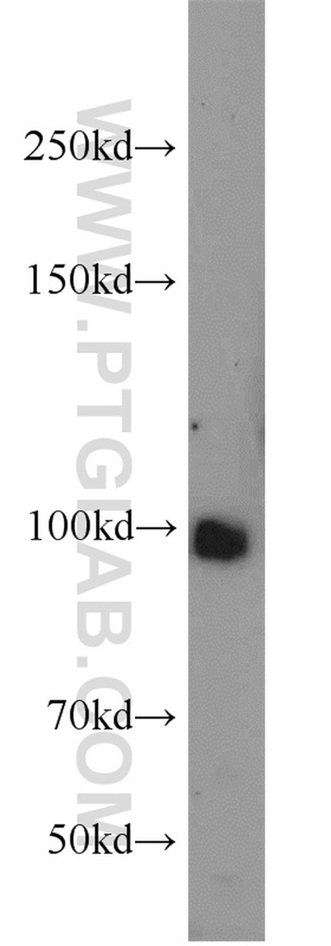 MME/CD10 Antibody in Western Blot (WB)