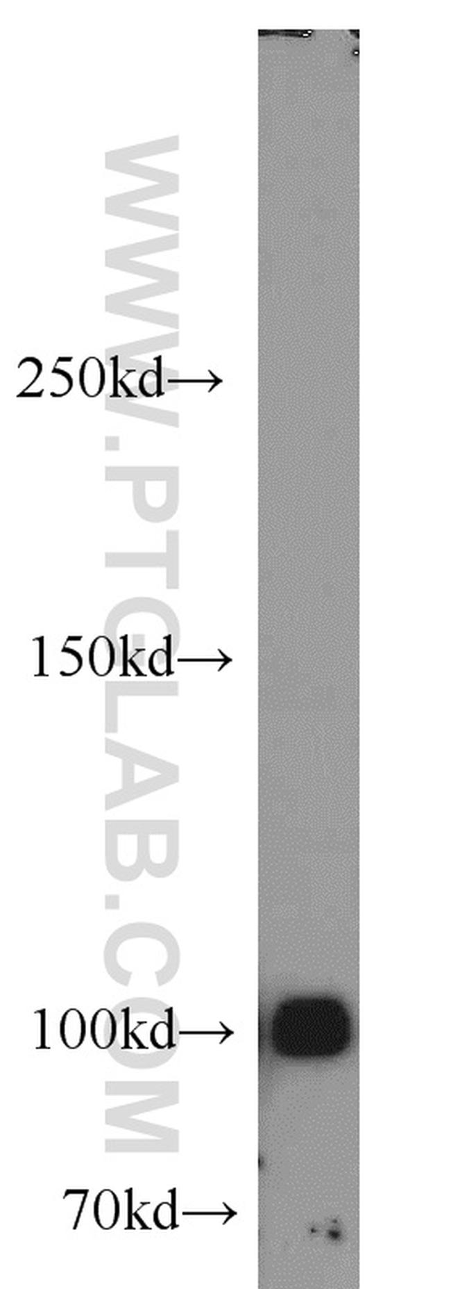 MME/CD10 Antibody in Western Blot (WB)