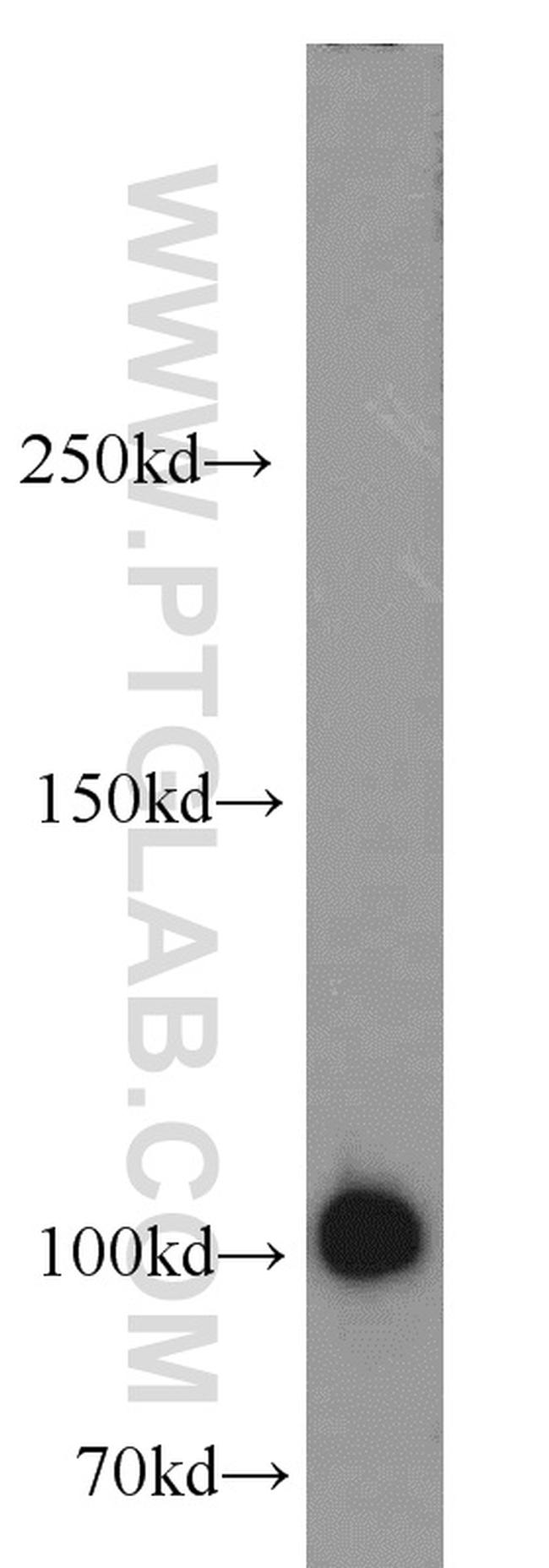 MME/CD10 Antibody in Western Blot (WB)