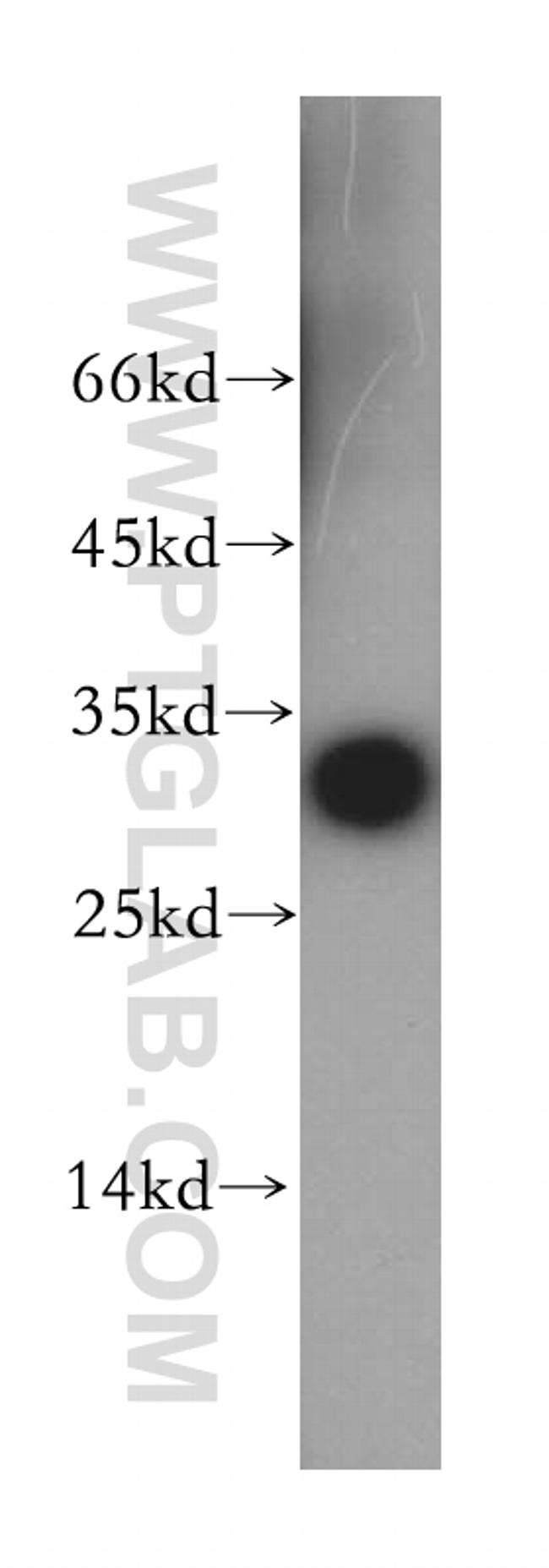 Nucleoside phosphorylase Antibody in Western Blot (WB)