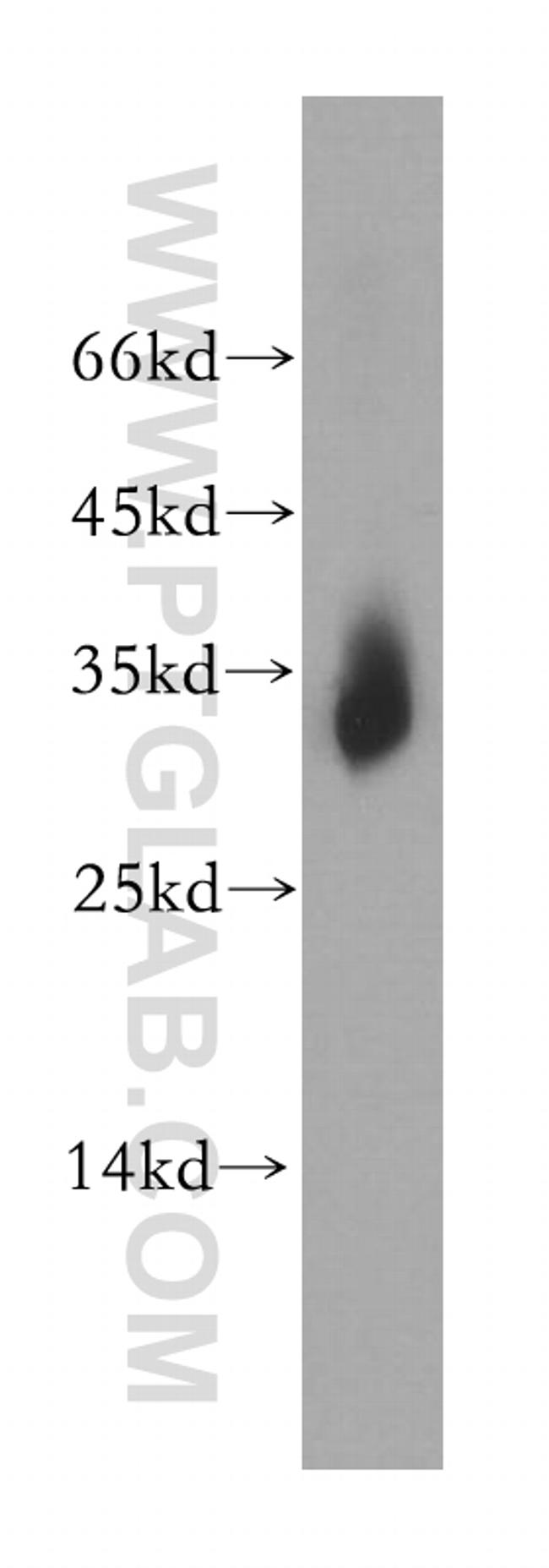 Nucleoside phosphorylase Antibody in Western Blot (WB)