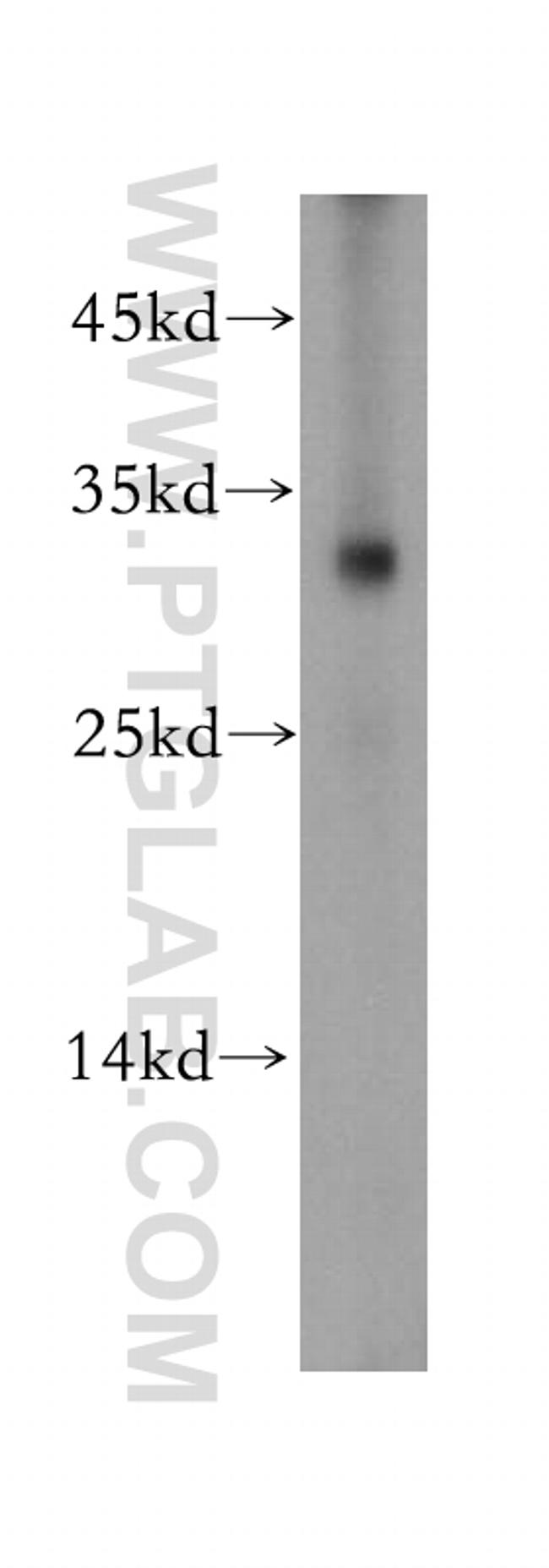 Nucleoside phosphorylase Antibody in Western Blot (WB)