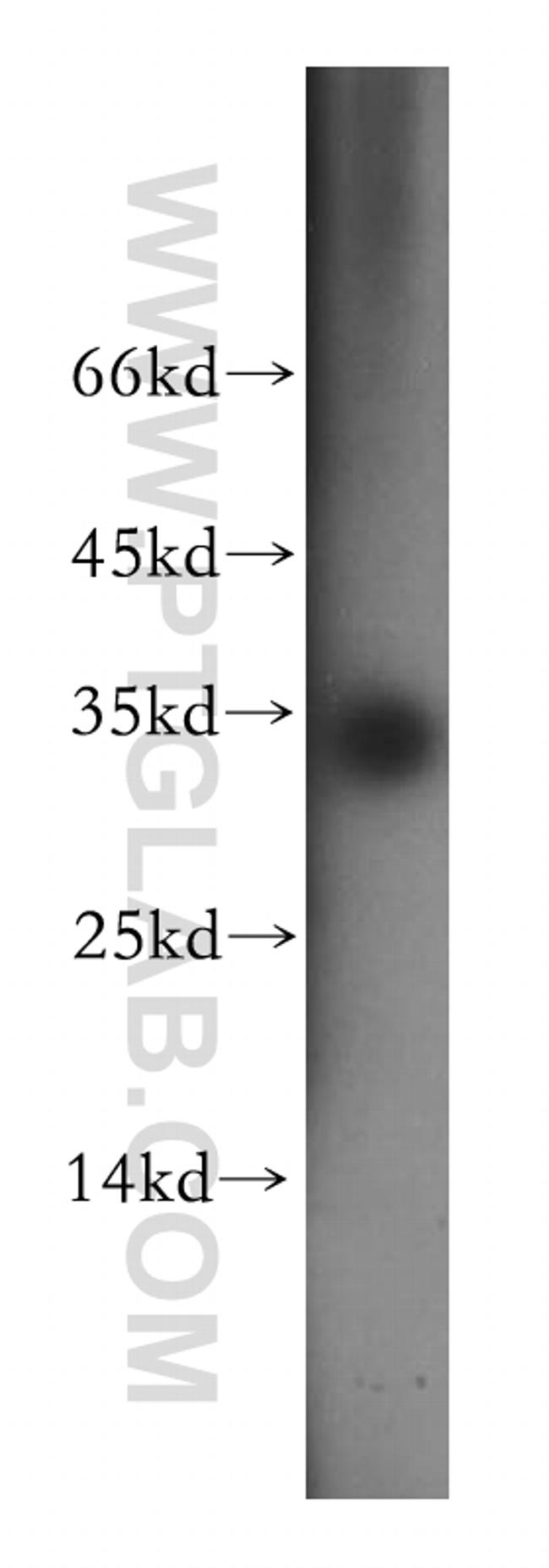 EIF2B1 Antibody in Western Blot (WB)