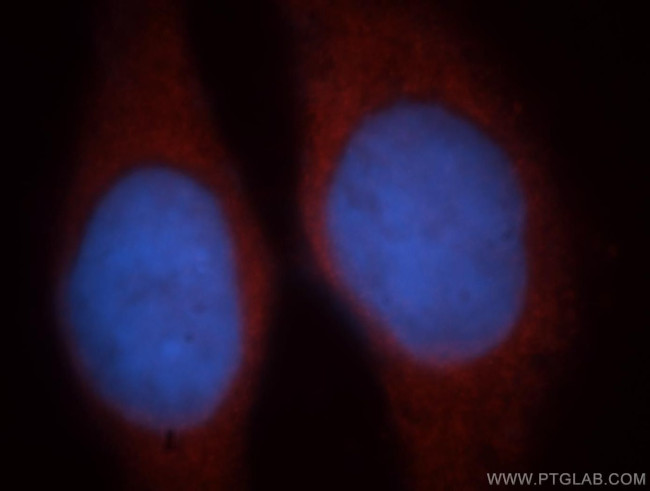 EIF2B1 Antibody in Immunocytochemistry (ICC/IF)