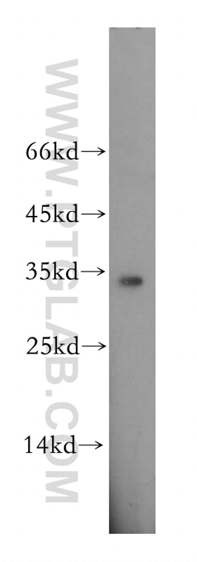 EIF2B1 Antibody in Western Blot (WB)