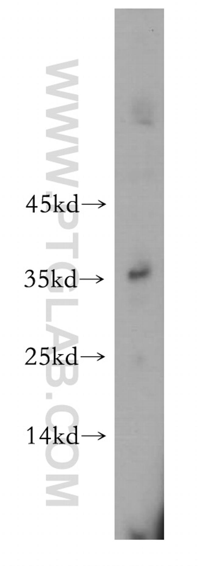 ATPAF1 Antibody in Western Blot (WB)
