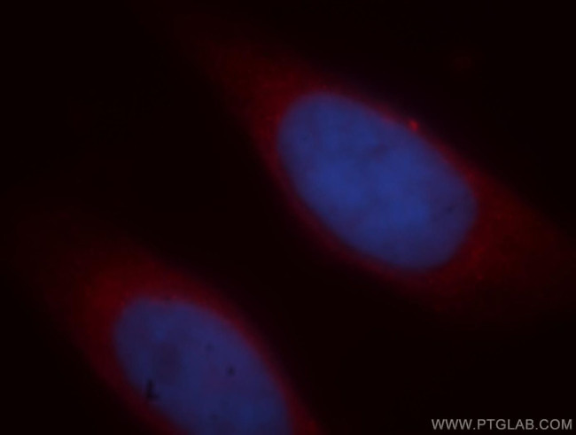 ICA1L Antibody in Immunocytochemistry (ICC/IF)