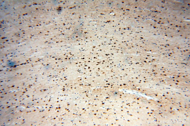 ICA1L Antibody in Immunohistochemistry (Paraffin) (IHC (P))