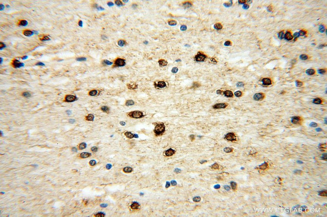 ICA1L Antibody in Immunohistochemistry (Paraffin) (IHC (P))