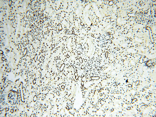 SART3 Antibody in Immunohistochemistry (Paraffin) (IHC (P))