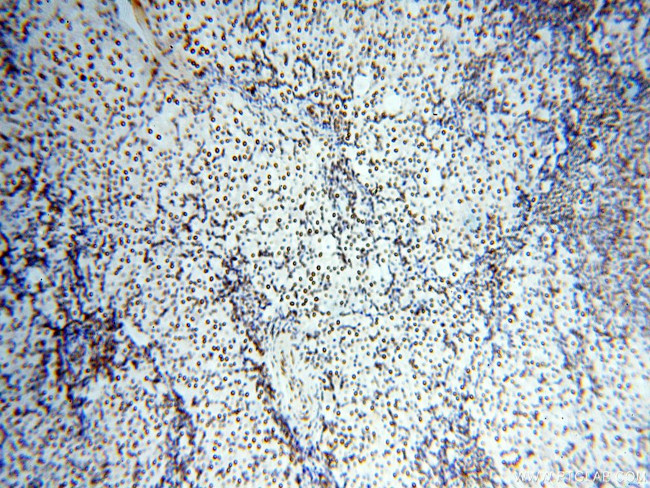 SART3 Antibody in Immunohistochemistry (Paraffin) (IHC (P))