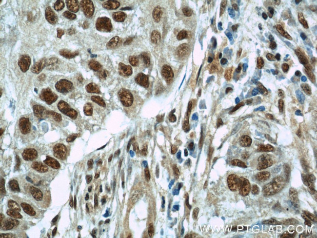 SART3 Antibody in Immunohistochemistry (Paraffin) (IHC (P))