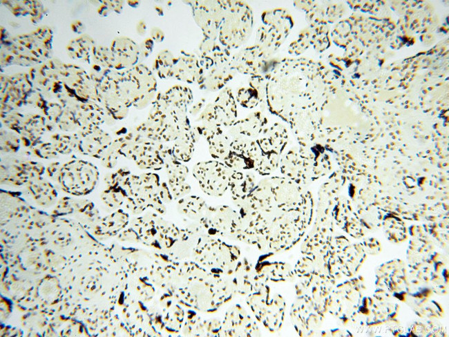 SART3 Antibody in Immunohistochemistry (Paraffin) (IHC (P))