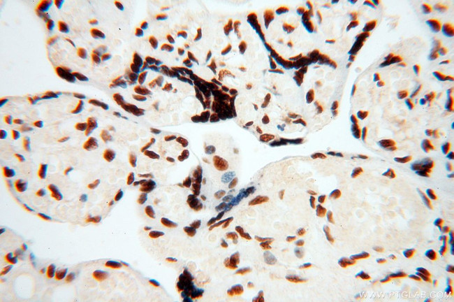 SART3 Antibody in Immunohistochemistry (Paraffin) (IHC (P))