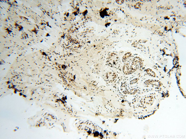 SART3 Antibody in Immunohistochemistry (Paraffin) (IHC (P))