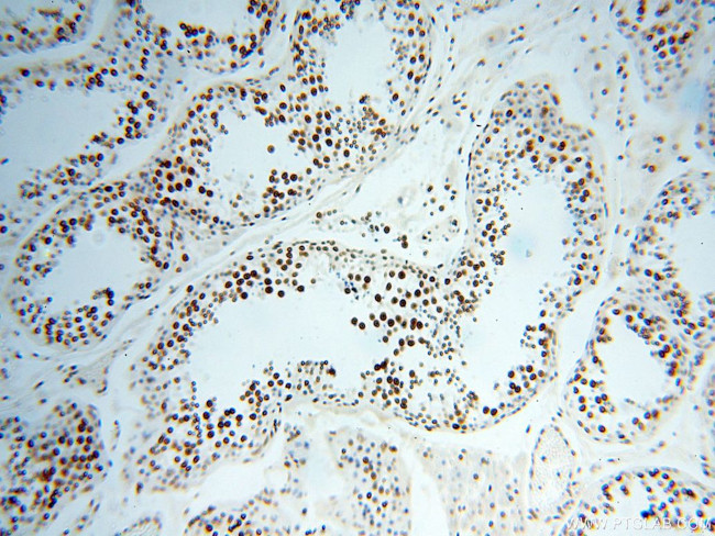 SART3 Antibody in Immunohistochemistry (Paraffin) (IHC (P))