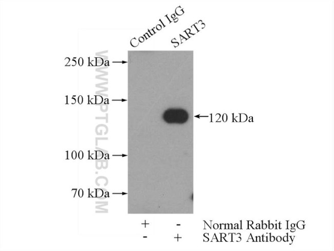 SART3 Antibody in Immunoprecipitation (IP)