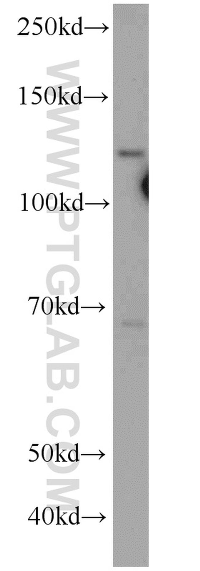 SART3 Antibody in Western Blot (WB)