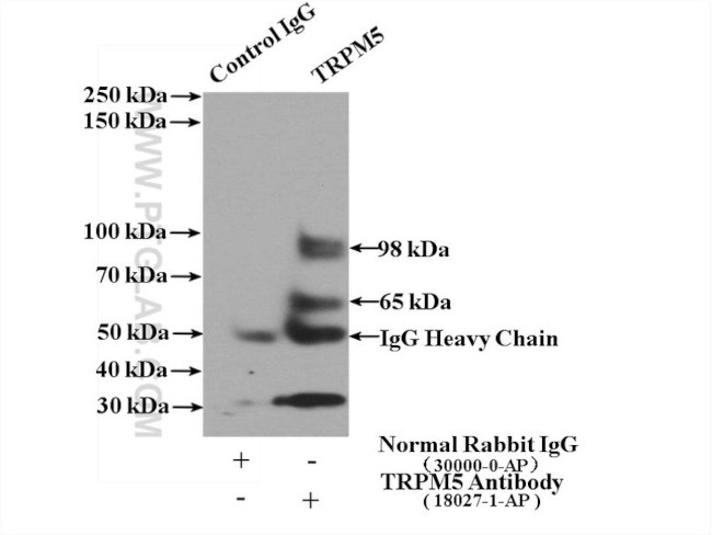 TRPM5 Antibody in Immunoprecipitation (IP)