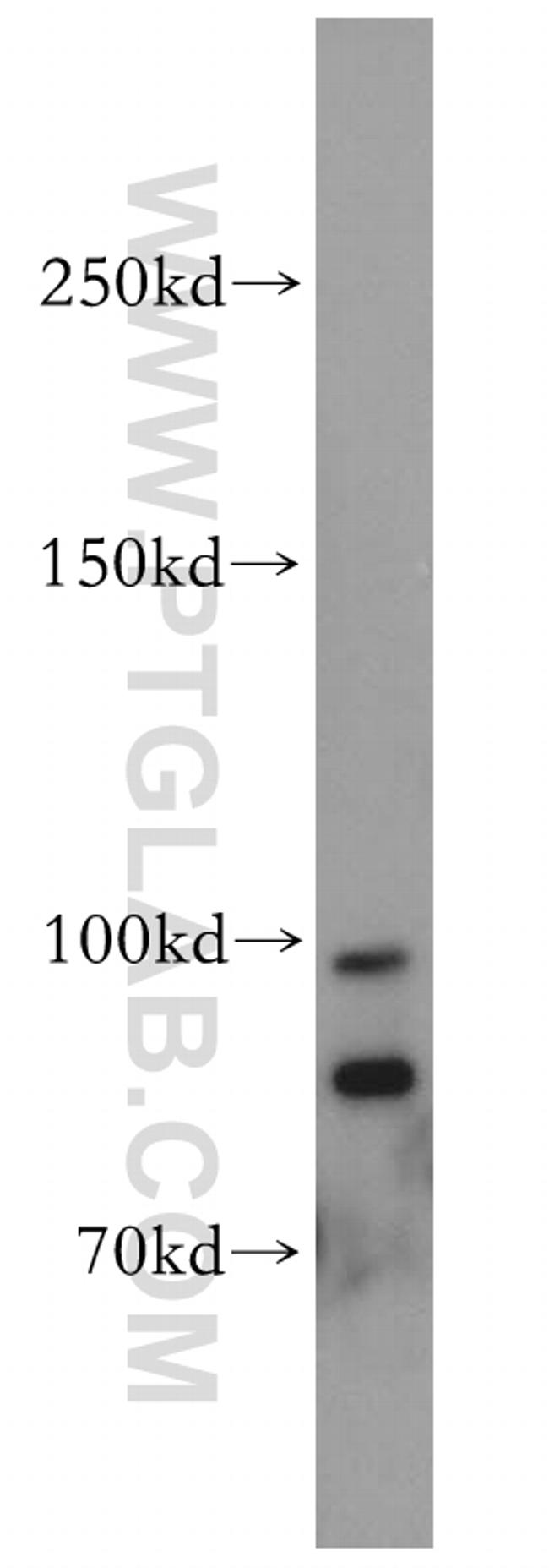 TRPM5 Antibody in Western Blot (WB)