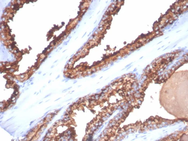 CD26 (DPP IV/ADA-Binding Protein) Antibody in Immunohistochemistry (Paraffin) (IHC (P))