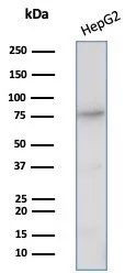 CD26 (DPP IV/ADA-Binding Protein) Antibody in Western Blot (WB)