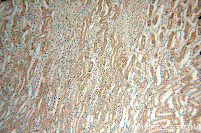 EDAR Antibody in Immunohistochemistry (Paraffin) (IHC (P))