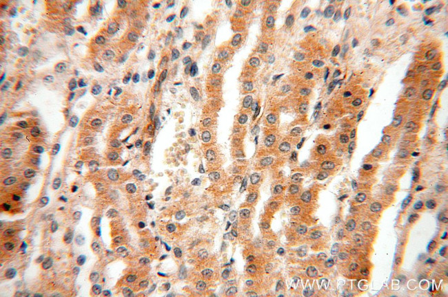 EDAR Antibody in Immunohistochemistry (Paraffin) (IHC (P))