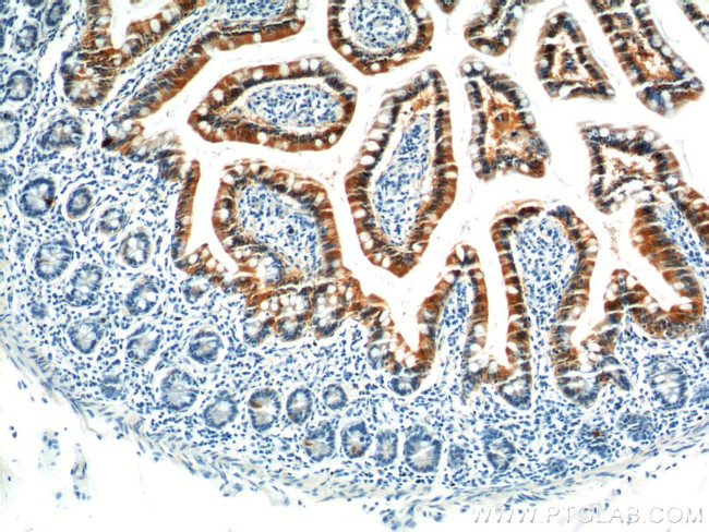 GIP Antibody in Immunohistochemistry (Paraffin) (IHC (P))