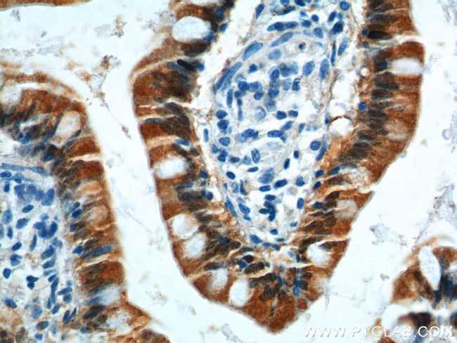 GIP Antibody in Immunohistochemistry (Paraffin) (IHC (P))