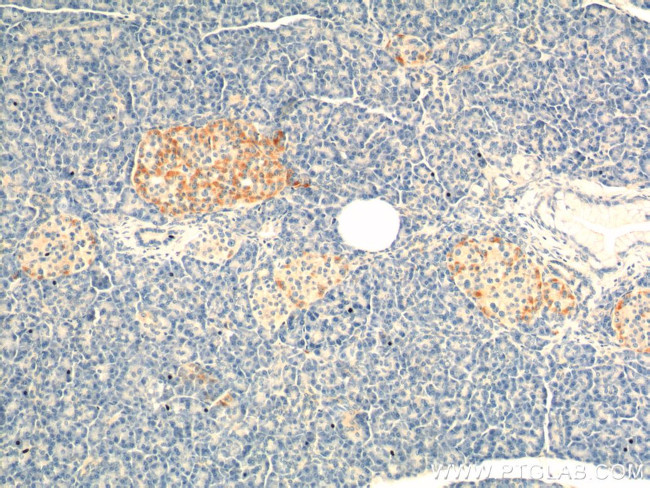 GIP Antibody in Immunohistochemistry (Paraffin) (IHC (P))